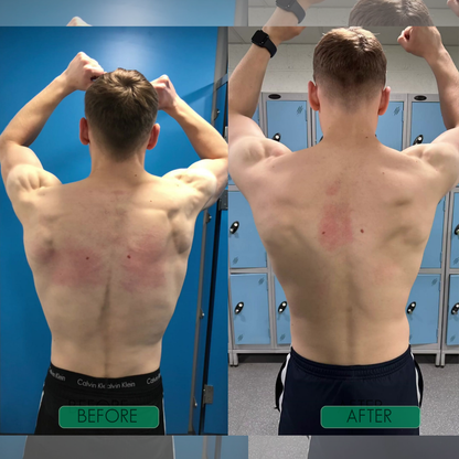 The 30-Second Shortcut to Perfect Posture. (LIMITED BOGO SALE)