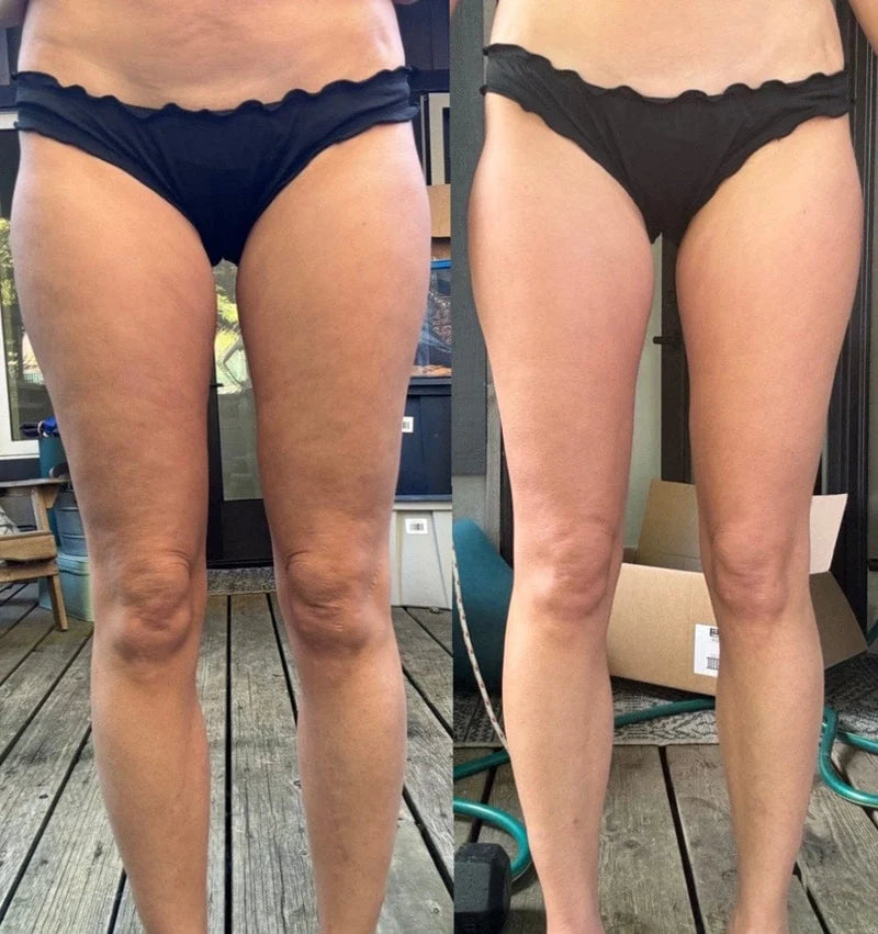 SMOOTHE Glow Gummies | Cellulite Support & Skin Smoothing Supplement