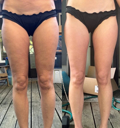 SMOOTHE Glow Gummies | Cellulite Support & Skin Smoothing Supplement