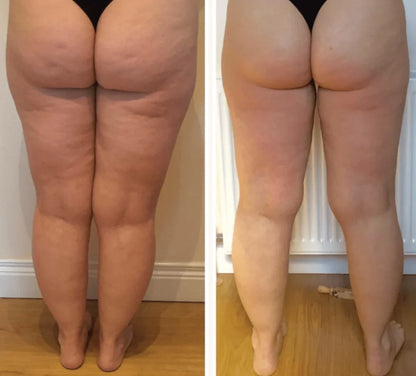 SMOOTHE Glow Gummies | Cellulite Support & Skin Smoothing Supplement