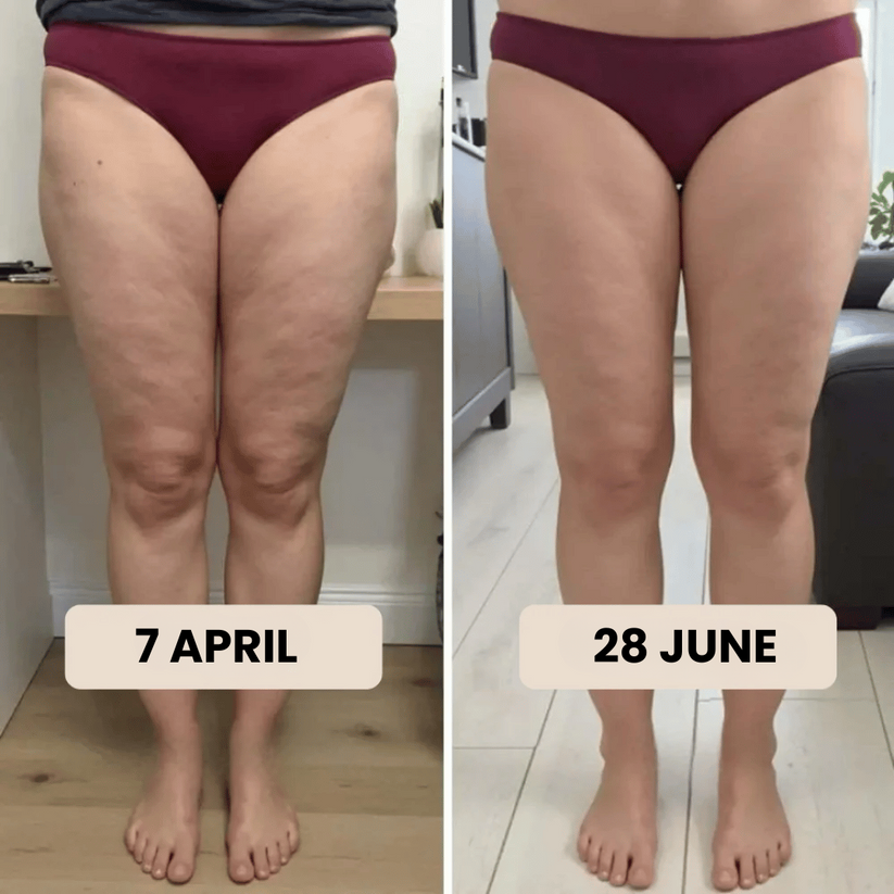 Empiriya 4D Sculpting Leggings - Advanced Cellulite Reduction & Weight Loss